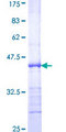 E2F2 Protein - 12.5% SDS-PAGE Stained with Coomassie Blue.