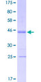 E2F3 Protein - 12.5% SDS-PAGE Stained with Coomassie Blue.