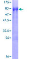 E2F4 Protein - 12.5% SDS-PAGE of human E2F4 stained with Coomassie Blue