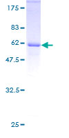 E2F6 Protein - 12.5% SDS-PAGE of human E2F6 stained with Coomassie Blue