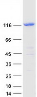 E4 / UBE4A Protein - Purified recombinant protein UBE4A was analyzed by SDS-PAGE gel and Coomassie Blue Staining
