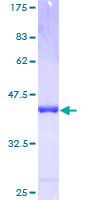 E48 / LY6D Protein - 12.5% SDS-PAGE of human LY6D stained with Coomassie Blue