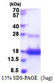 E48 / LY6D Protein