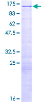 E4F1 / E4F Protein - 12.5% SDS-PAGE of human E4F1 stained with Coomassie Blue