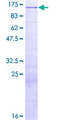 E4F1 / E4F Protein - 12.5% SDS-PAGE of human E4F1 stained with Coomassie Blue