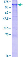 E6AP / UBE3A Protein - 12.5% SDS-PAGE of human UBE3A stained with Coomassie Blue