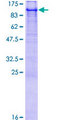 E6AP / UBE3A Protein - 12.5% SDS-PAGE of human UBE3A stained with Coomassie Blue