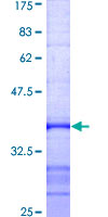 E6AP / UBE3A Protein - 12.5% SDS-PAGE Stained with Coomassie Blue.