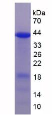 E6AP / UBE3A Protein - Recombinant Ubiquitin Protein Ligase E3A By SDS-PAGE