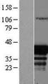 EAF1 / ELL Associated Factor 1 Protein - Western validation with an anti-DDK antibody * L: Control HEK293 lysate R: Over-expression lysate