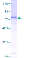 EAF1 / ELL Associated Factor 1 Protein - 12.5% SDS-PAGE of human EAF1 stained with Coomassie Blue