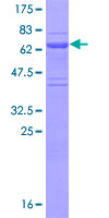 EAF2 / U19 Protein - 12.5% SDS-PAGE of human EAF2 stained with Coomassie Blue