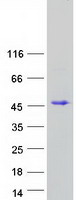 EAF2 / U19 Protein - Purified recombinant protein EAF2 was analyzed by SDS-PAGE gel and Coomassie Blue Staining