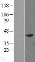 EAPP Protein - Western validation with an anti-DDK antibody * L: Control HEK293 lysate R: Over-expression lysate