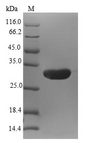 EAR2 / NR2F6 Protein - (Tris-Glycine gel) Discontinuous SDS-PAGE (reduced) with 5% enrichment gel and 15% separation gel.