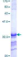 EAR2 / NR2F6 Protein - 12.5% SDS-PAGE Stained with Coomassie Blue.