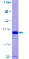 EAT2 / SH2D1B Protein - 12.5% SDS-PAGE of human SH2D1B stained with Coomassie Blue