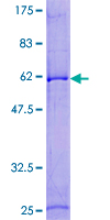 EBAG9 / RCAS1 Protein - 12.5% SDS-PAGE of human EBAG9 stained with Coomassie Blue