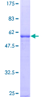 EBAG9 / RCAS1 Protein - 12.5% SDS-PAGE of human EBAG9 stained with Coomassie Blue