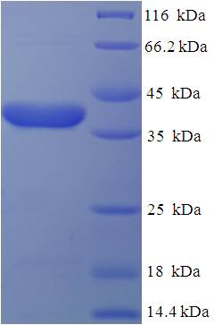 EBAG9 / RCAS1 Protein
