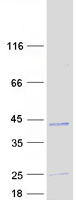 EBAG9 / RCAS1 Protein - Purified recombinant protein EBAG9 was analyzed by SDS-PAGE gel and Coomassie Blue Staining