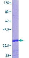 EBF4 Protein - 12.5% SDS-PAGE of human EBF4 stained with Coomassie Blue