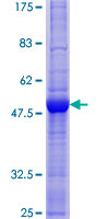 EBI3 / IL-27B Protein - 12.5% SDS-PAGE of human EBI3 stained with Coomassie Blue