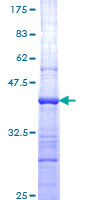 EBI3 / IL-27B Protein - 12.5% SDS-PAGE Stained with Coomassie Blue.