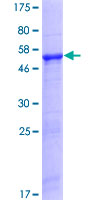 EBS / NAT9 Protein - 12.5% SDS-PAGE of human NAT9 stained with Coomassie Blue