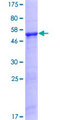 EBS / NAT9 Protein - 12.5% SDS-PAGE of human NAT9 stained with Coomassie Blue