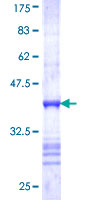 ECaC / TRPV5 Protein - 12.5% SDS-PAGE Stained with Coomassie Blue.