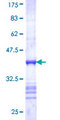 ECaC / TRPV5 Protein - 12.5% SDS-PAGE Stained with Coomassie Blue.