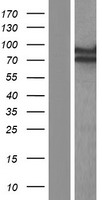 ECD Protein - Western validation with an anti-DDK antibody * L: Control HEK293 lysate R: Over-expression lysate