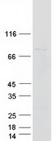 ECD Protein - Purified recombinant protein ECD was analyzed by SDS-PAGE gel and Coomassie Blue Staining