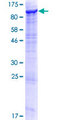 ECE-1 Protein - 12.5% SDS-PAGE of human ECE1 stained with Coomassie Blue