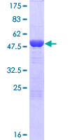 ECE2 Protein - 12.5% SDS-PAGE of human ECE2 stained with Coomassie Blue