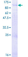 ECEL1 Protein - 12.5% SDS-PAGE of human ECEL1 stained with Coomassie Blue
