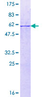 ECH1 Protein - 12.5% SDS-PAGE of human ECH1 stained with Coomassie Blue