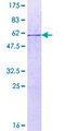 ECH1 Protein - 12.5% SDS-PAGE of human ECH1 stained with Coomassie Blue