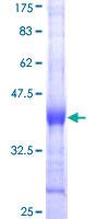 ECH1 Protein - 12.5% SDS-PAGE Stained with Coomassie Blue.