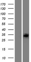 ECHDC1 Protein - Western validation with an anti-DDK antibody * L: Control HEK293 lysate R: Over-expression lysate