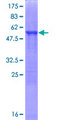 ECHDC1 Protein - 12.5% SDS-PAGE of human ECHDC1 stained with Coomassie Blue