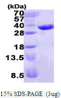 ECHDC1 Protein