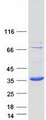 ECHDC1 Protein - Purified recombinant protein ECHDC1 was analyzed by SDS-PAGE gel and Coomassie Blue Staining