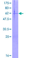 ECHDC2 Protein - 12.5% SDS-PAGE of human ECHDC2 stained with Coomassie Blue