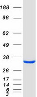 ECHDC3 Protein - Purified recombinant protein ECHDC3 was analyzed by SDS-PAGE gel and Coomassie Blue Staining