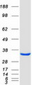 ECHDC3 Protein - Purified recombinant protein ECHDC3 was analyzed by SDS-PAGE gel and Coomassie Blue Staining