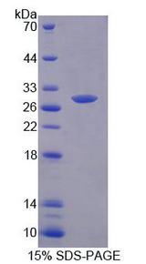 ECI2 / PECI Protein - Recombinant Peroxisomal D3, D2-Enoyl Coenzyme A Isomerase (PECI) by SDS-PAGE