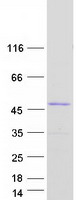 ECI2 / PECI Protein - Purified recombinant protein ECI2 was analyzed by SDS-PAGE gel and Coomassie Blue Staining