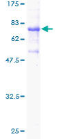 ECSIT Protein - 12.5% SDS-PAGE of human ECSIT stained with Coomassie Blue